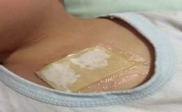 Ovaj kućni lijek rastvara sluz u plućima i oslobađa kašlja. Preko noći uklanja i najteži kašalj, te čisti pluća od nakupljene sluzi!