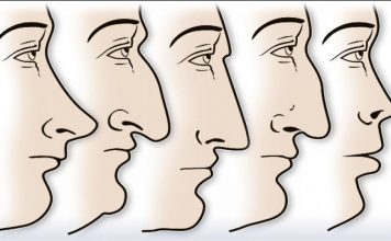 ZVUČI ČUDNO, ALI JE ISTINITO: Evo šta OBLIK NOSA govori O VAMA! Svima je pogodilo