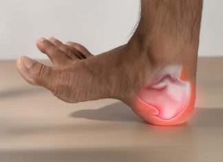 Oslobodite se bolova u peti na brz način! Kako razbiti petni trn? Metoda za ublažavanja boli