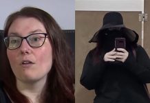 Samo 20 minuta na suncu je za Emili dovoljno da završi u bolnici: Zbog retkog problema spava danju i izlazi noću, a šok je šta mora da radi kada napušta kuću