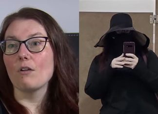 Samo 20 minuta na suncu je za Emili dovoljno da završi u bolnici: Zbog retkog problema spava danju i izlazi noću, a šok je šta mora da radi kada napušta kuću