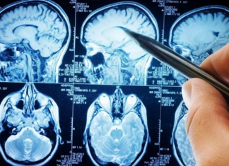 POVRĆE JE TOLIKO ZDRAVO DA O NJEMU PIŠE NJUJORK TAJMS: Amerikanci daju po 30 dolara za jedan list, a ono raste kod nas