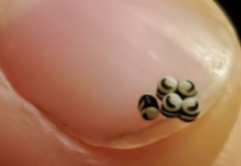 Tiha večera pretvorila se u noćnu moru kada smo u salati pronašli pomične crne točkice — ono što se dogodilo nakon toga odvelo nas je ravno u bolnicu