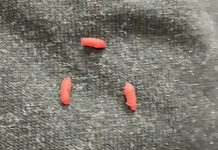 Mislila sam da su to samo dlačice na mom džemperu – dok nisam otkrila što su zapravo