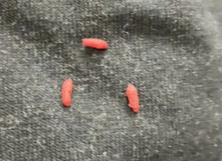 Mislila sam da su to samo dlačice na mom džemperu – dok nisam otkrila što su zapravo