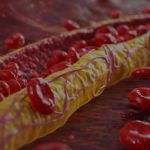 Ovi znaci na nogama pokazuju da imate izuzetno visok holesterol: Ne smijete ih ignorisati, posljedice su fatalne po tijelo