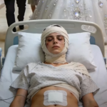 Moji roditelji su odbili da mi pomognu nakon operacije, govoreći da je kupovina vjenčanice za moju sestru važnija. Prekinula sam svaki kontakt s njima i posvetila se svom oporavku. Tri mjeseca kasnije nazvali su me u panici. Rata kredita im nije prošla. Odgovorila sam im: izgleda da ćete morati pronaći novog sponzora.