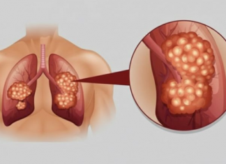 PUŠAČI, PAŽNJA! Za 3 dana izbacite sve otrove iz tijela: Ova metoda skida OTROV SA ZIDOVA PLUĆA, sprečava rak, izbacuje masnoće i višak vode!