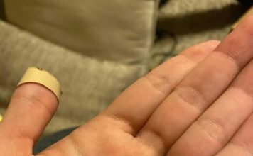 Kupila sam toalet papir, a unutra su bile ovakve male zelene kuglice – da li neko zna šta je to?