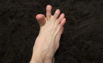DA LI VAM SE GRČE PRSTI NA STOPALIMA? Evo Na Šta Vas To Upozorava, Može Biti Znak Većih Problema