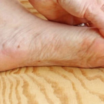 7 znakova da se tijelo već duže vrijeme bori s VISOKIM ŠEĆEROM U KRVI: Prvo ćete to primijetiti na očima i nogama!