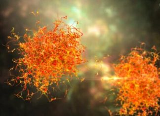 3 simptoma metastaze raka koji se javljaju rano ujutru: 0VAJ ZNAK JE crveni alaram, a svi ga zanemare …