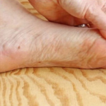 7 znakova da se tijelo već duže vrijeme bori s VISOKIM ŠEĆEROM U KRVI: Prvo ćete to primijetiti na očima i nogama!