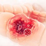 RAK DEBELOG CREVA ŠALJE OVIH 7 SIGNALA: 90% ljudi neće obratiti pažnju na ove znake, ali to može da im spase život RAK DEBELOG CREVA ŠALJE OVIH 7 SIGNALA: 90% ljudi neće obratiti pažnju na ove znake, ali to može da im spase život - featured image