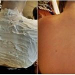 Izgorela je na suncu, a ovo ju je spasilo za 30 minuta: Svi to imamo u kući, a nije jogurt Izgorela je na suncu, a ovo ju je spasilo za 30 minuta: Svi to imamo u kući, a nije jogurt - featured image