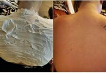 Izgorela je na suncu, a ovo ju je spasilo za 30 minuta: Svi to imamo u kući, a nije jogurt Izgorela je na suncu, a ovo ju je spasilo za 30 minuta: Svi to imamo u kući, a nije jogurt - featured image