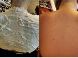 Izgorela je na suncu, a ovo ju je spasilo za 30 minuta: Svi to imamo u kući, a nije jogurt - featured image