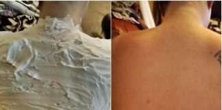 Izgorela je na suncu, a ovo ju je spasilo za 30 minuta: Svi to imamo u kući, a nije jogurt - featured image