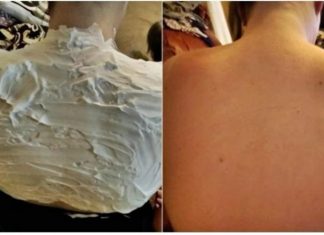 Izgorela je na suncu, a ovo ju je spasilo za 30 minuta: Svi to imamo u kući, a nije jogurt Izgorela je na suncu, a ovo ju je spasilo za 30 minuta: Svi to imamo u kući, a nije jogurt - featured image