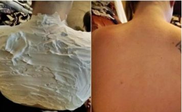 Izgorela je na suncu, a ovo ju je spasilo za 30 minuta: Svi to imamo u kući, a nije jogurt - featured image