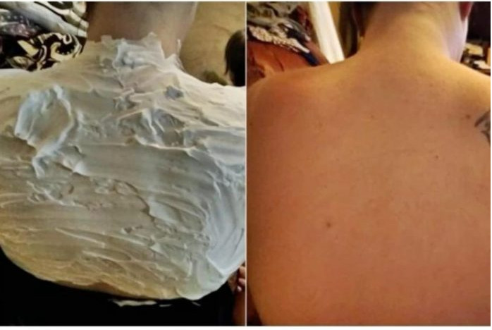 Izgorela je na suncu, a ovo ju je spasilo za 30 minuta: Svi to imamo u kući, a nije jogurt - featured image Izgorela je na suncu, a ovo ju je spasilo za 30 minuta: Svi to imamo u kući, a nije jogurt - featured image