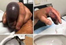 Seo je na WC šolju ne sluteći da se ispod krije ozbiljan problem, a nekoliko sekundi kasnije sve se promenilo