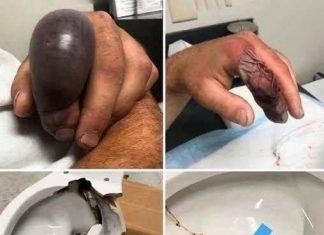 Seo je na WC šolju ne sluteći da se ispod krije ozbiljan problem, a nekoliko sekundi kasnije sve se promenilo