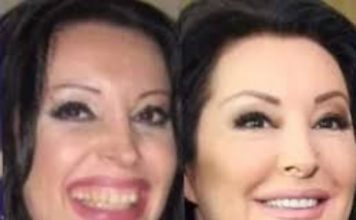 POGLEDAJTE kako su izgledale domaće ličnosti PRIJE UMJETNIH ZUBA – CECA JE HIT (FOTO)