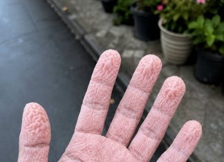 Ovo su posljedice korištenja previše m…