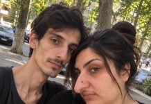 Godinama su se ljudi rugali mom nosu, a nakon operacije moj je muž uklonio sva ogledala iz naše kuće — ali kada je netko pokucao na vrata, otkrila sam tko je zapravo svih tih godina učinio da se toliko sramim svog izgleda…