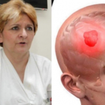 1 ČUDAN SIMPTOM UKAZUJE NA TUMOR! Dr Danica Grujičić otkrila znakove koji mogu otkriti da je bolest napala mozak