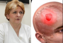 1 ČUDAN SIMPTOM UKAZUJE NA TUMOR! Dr Danica Grujičić otkrila znakove koji mogu otkriti da je bolest napala mozak