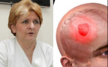 1 ČUDAN SIMPTOM UKAZUJE NA TUMOR! Dr Danica Grujičić otkrila znakove koji mogu otkriti da je bolest napala mozak