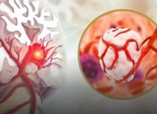 3 simptoma raka koji se javljaju ujutru: Upozoravaju na metastaze, a evo šta odmah treba uraditi